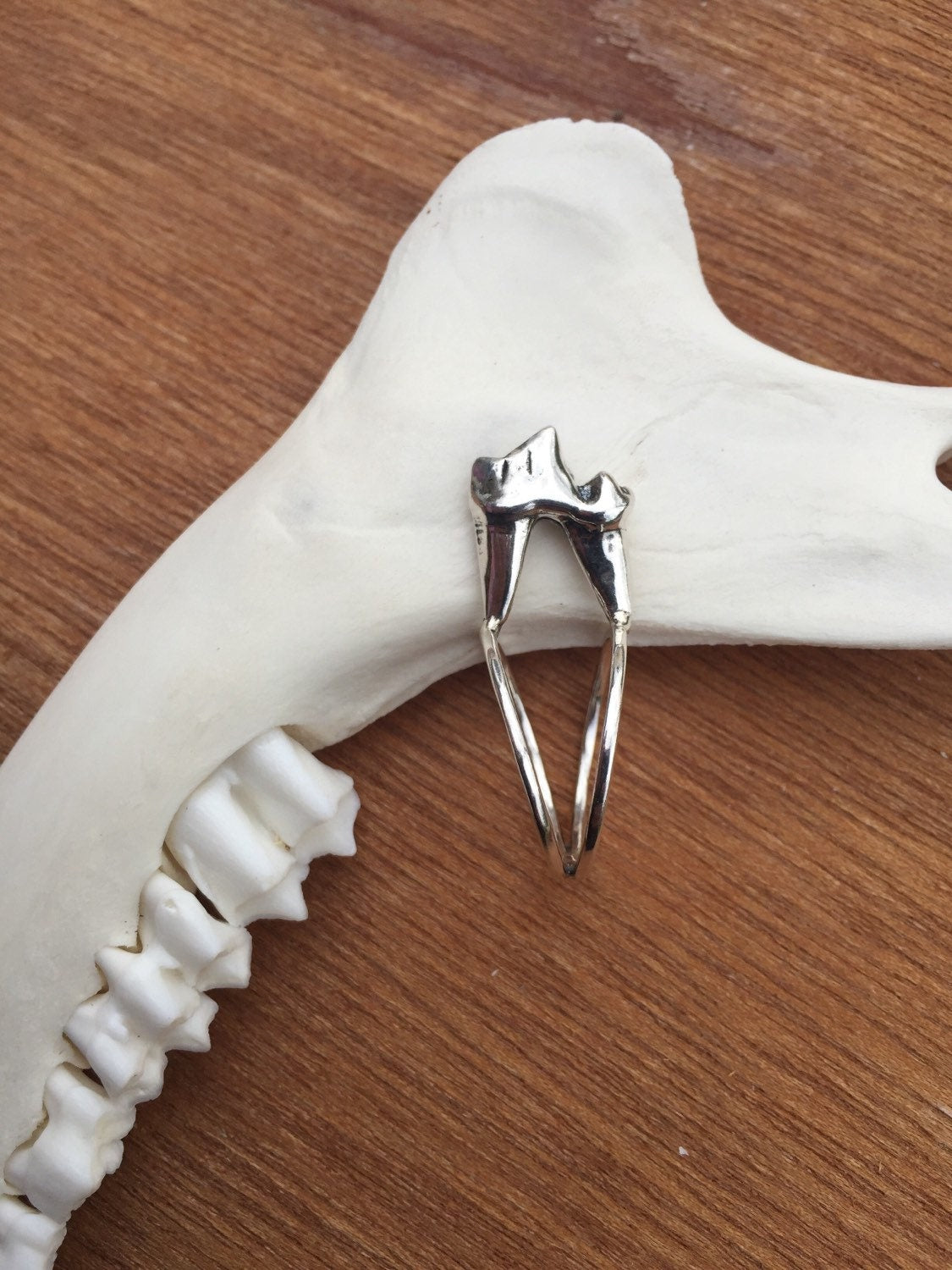Double band fox molar ring